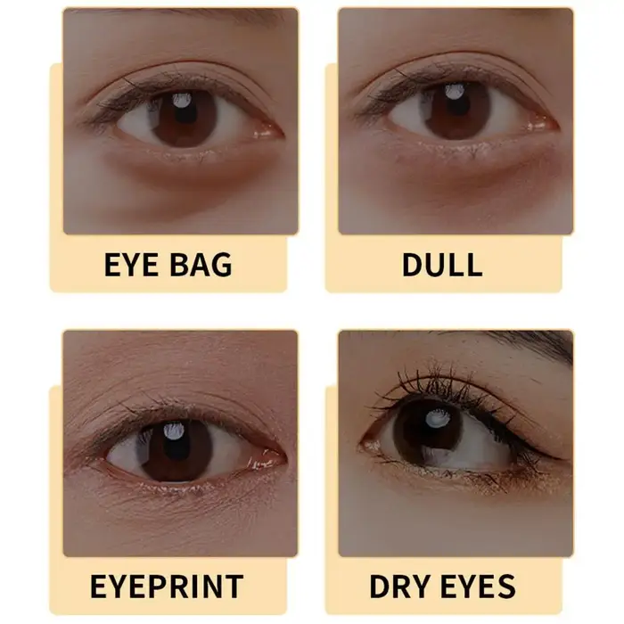 SADOER Sérum pour les yeux au rétinol 30 ml