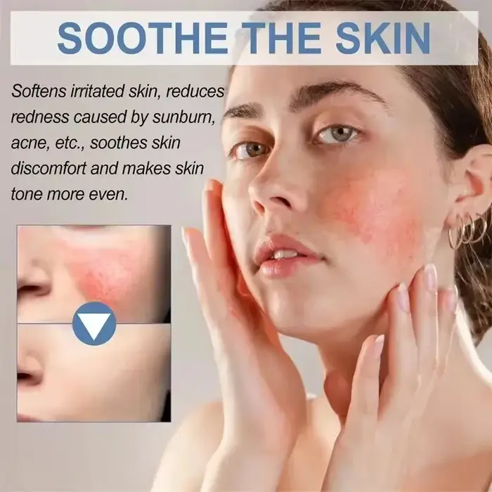 Crème Réparatrice Anti-Rougeurs Visage – Améliore la Peau Sensible et la Sécheresse – Hydratant Apaisant – Élimine la Rosacée – Cosmétiques Coréens