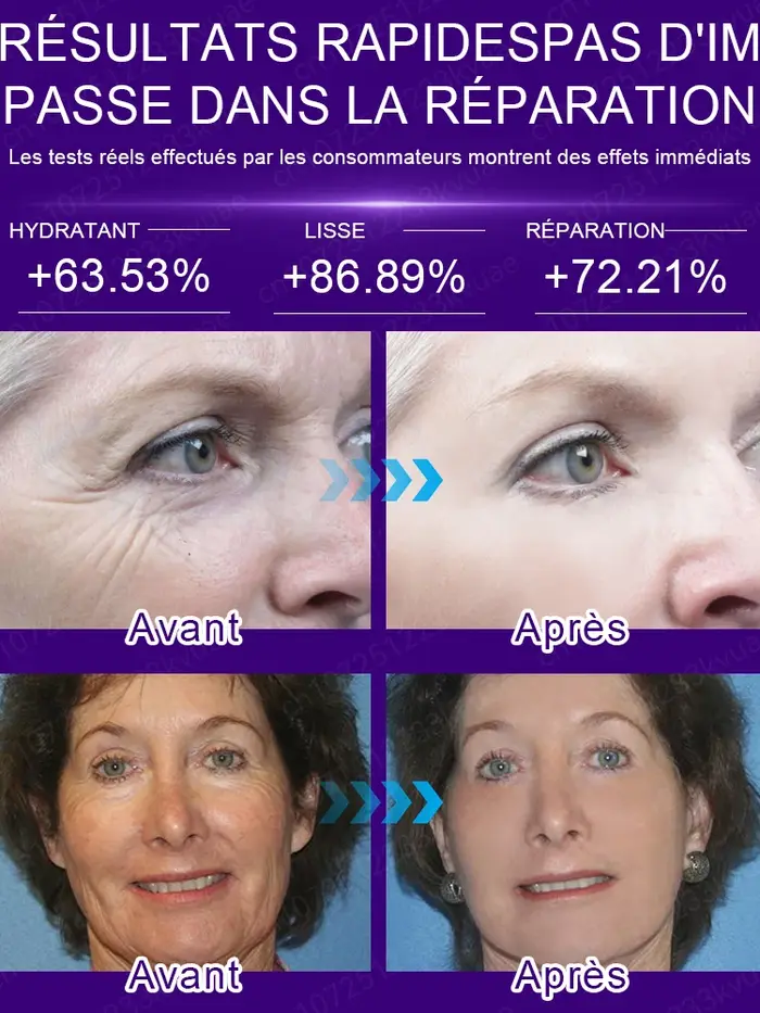 Pas de rides, 20 ans plus jeune