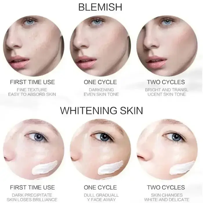 1/3/5 pièces crème blanchissante pour les taches de rousseur Niacinamide élimine