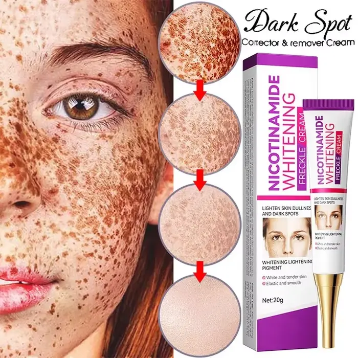 Crème éclaircissante douce à la niacinamide pour la peau