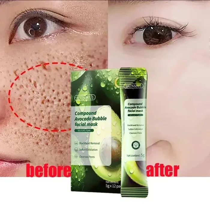 Masque rétrécissement des pores à l'acide salicylique