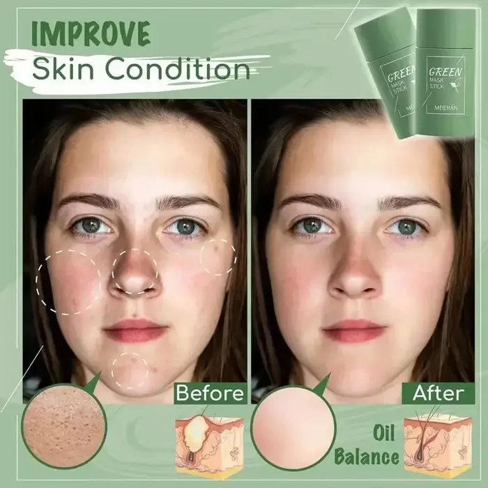 Masque Facial Original pour éliminer les points noirs