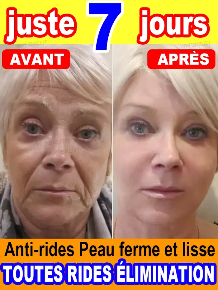 Pas de rides, 20 ans plus jeune