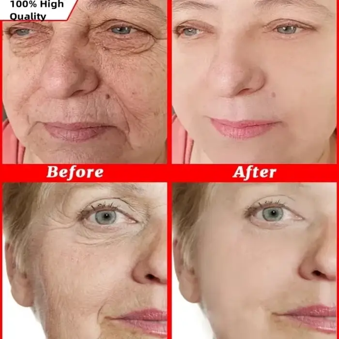 Crème anti-rides instantanée pour le visage