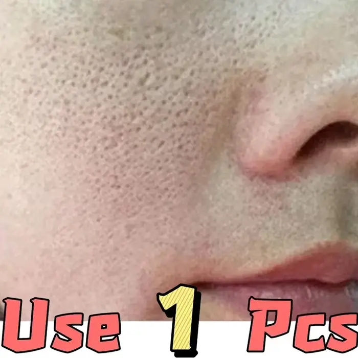 Peau lisse | Rétrécit les pores, sérum visage au rétinol et à la niacinamide