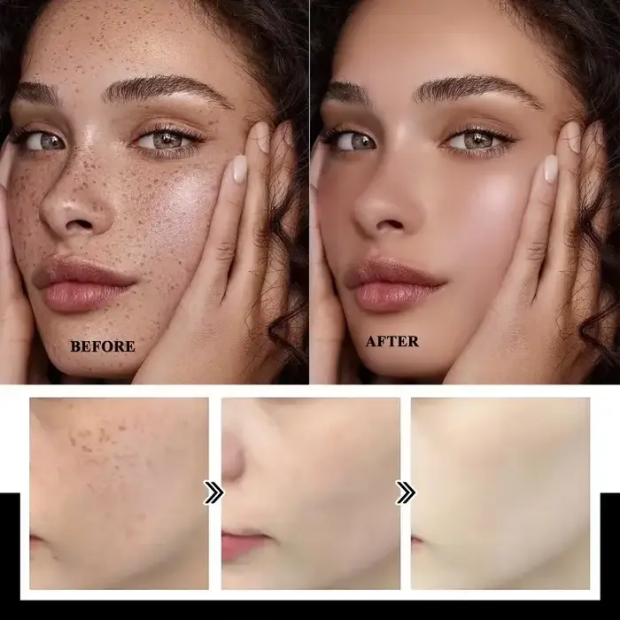 Crème éclaircissante douce à la niacinamide pour la peau