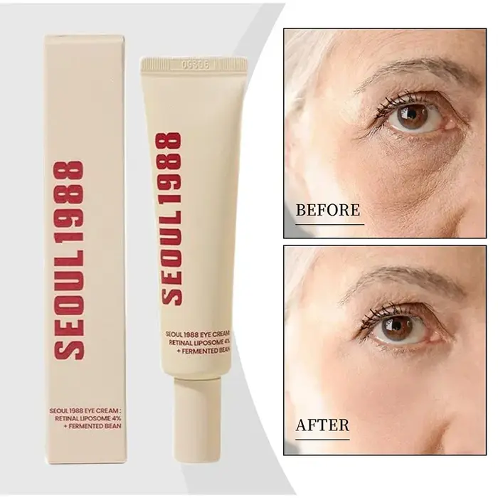 Séoul 1988 crème pour les yeux au rétinol traitement oculaire anti-âge pour les cernes