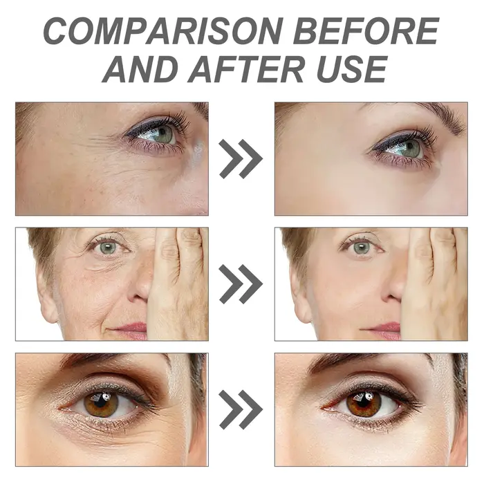 1/2 pièces coréen séoul 1988 rétinol visage sérum estompe les rides fines hydratant blanchissant enlever les taches rétrécissement des Pores beauté soins de la peau