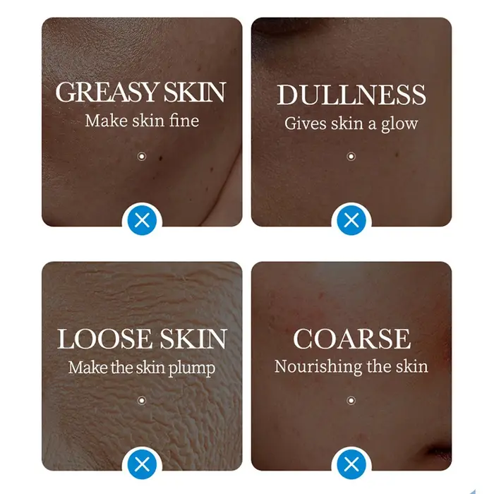 5 pièces SADOER masques de glace pour le visage hydratant en profondeur éclaircissant raffermissant masque feuille