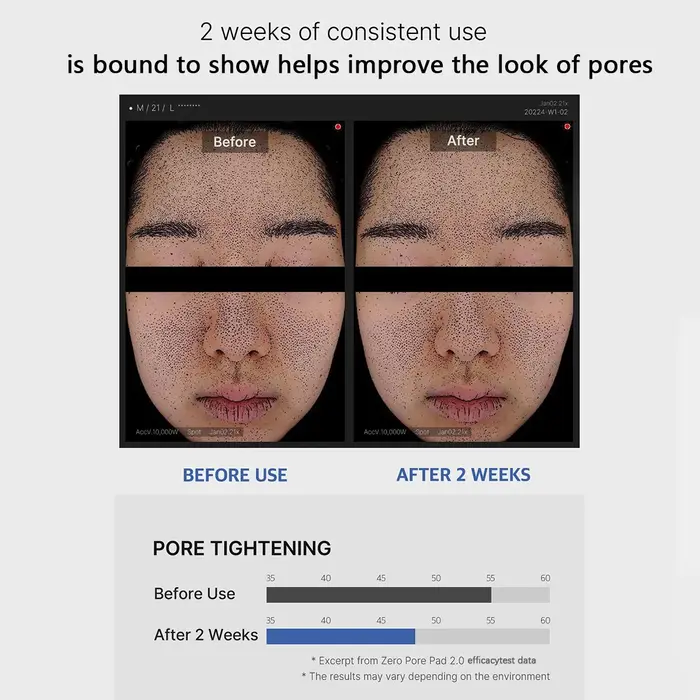 Medicube ZERO PORE PAD 2.0