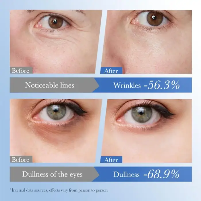 20g SADOER Caviar acide hyaluronique Anti-rides crème pour les yeux réparatrice hydratant raffermissant