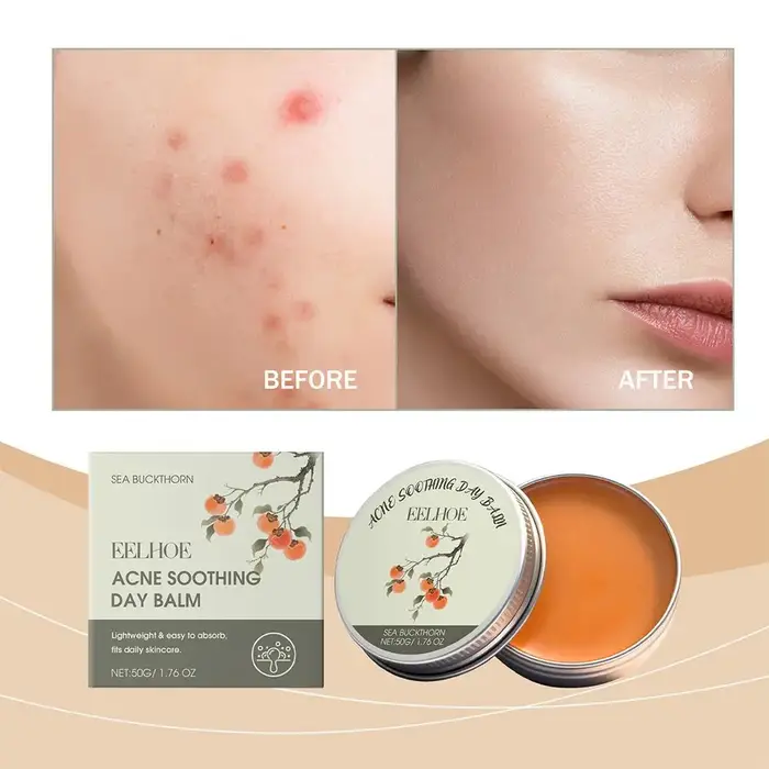 Baume anti-acné de jour avec acide salicylique