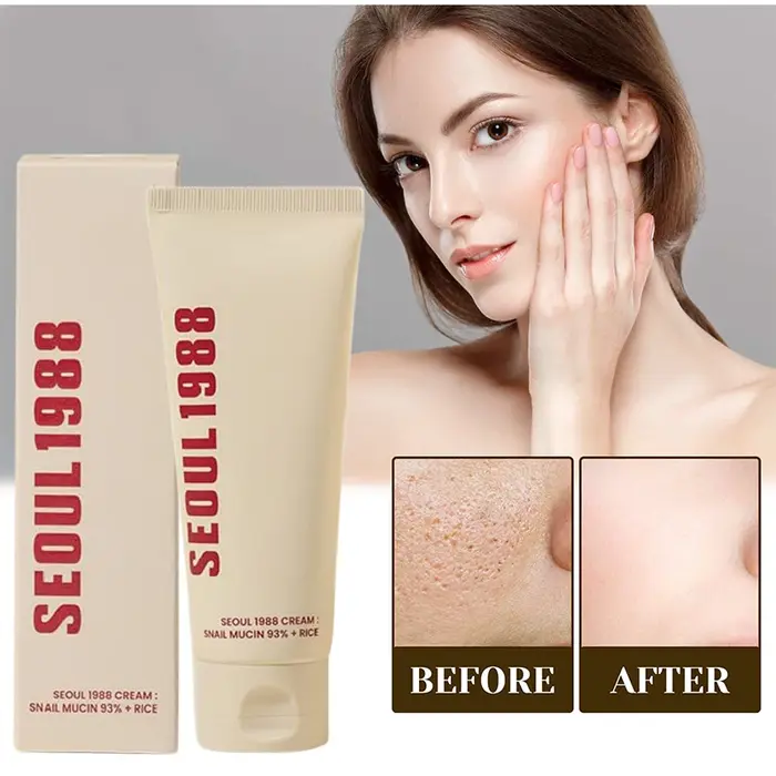 Coréen séoul 1988 crème pour les yeux escargot Mucin ensemble de soins de la peau blanchir