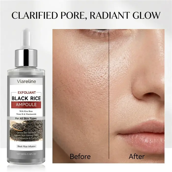 Sérum exfoliant au riz noir, solution nettoyante et exfoliante pour le visage, minimiseur de pores, 