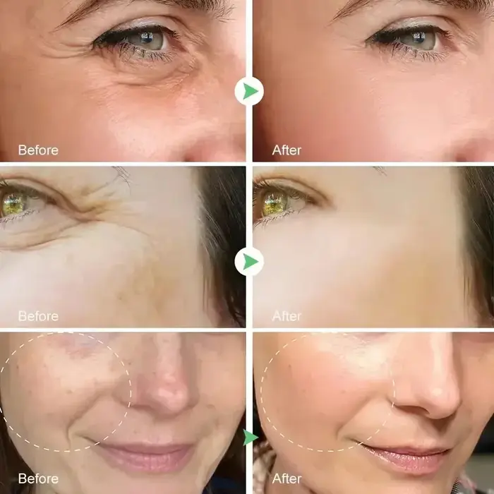 Sérum rétinol pour le visage