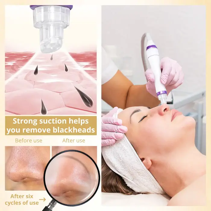 DermDelhi-Machine Hydro-Eau à Oxygène Professionnelle pour Soins de la Peau, Jet Peel Oxy Spray, Liv