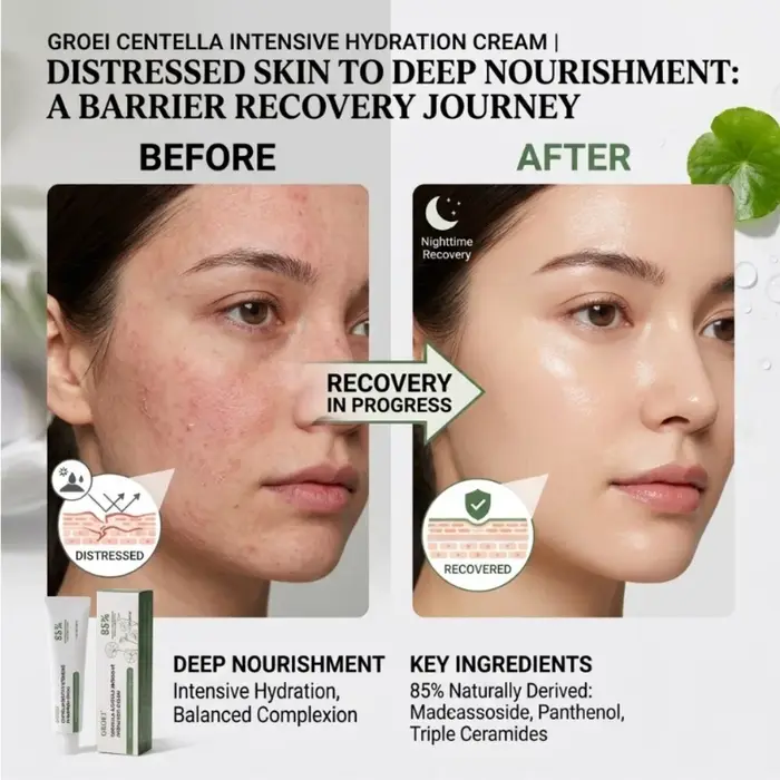 Crème pour le visage à la Centella Asiatica, réparatrice de la barrière cutanée à la céramide, hydratante pour les peaux sensibles sujettes à l'acné, crème de nuit apaisante et hydratante