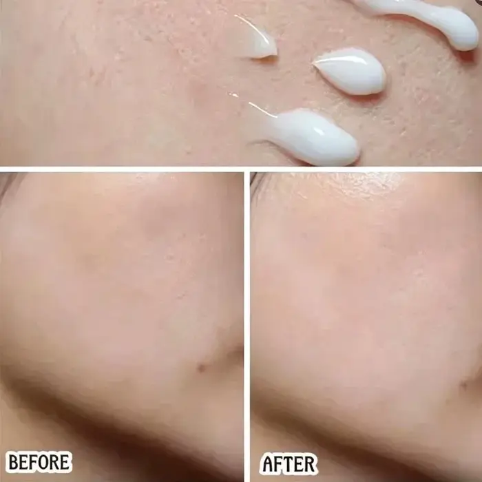 Crème et Brume Hydratante Dr.Althea 345 Relief 147 – Hydratation Intense et Éclaircissante – Produit de Soin Coréen Approuvé par les Célébrités