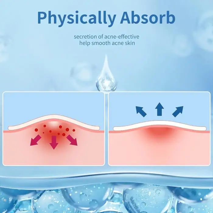 360 pièces visage acné Patch Invisible soins de la peau bouton