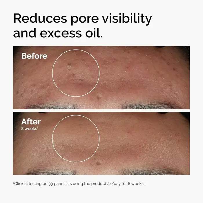 Sérum visage hydratant 30ml Acide Hyaluronique 2% + B5 & Niacinamide 10% + Zinc 1% pour une peau lisse