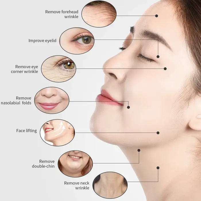 Beauty Star – Machine faciale tripolaire 3 en 1