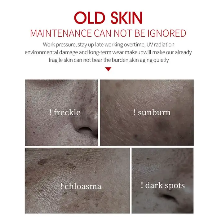 Crème anti-taches de rousseur pour le visage
