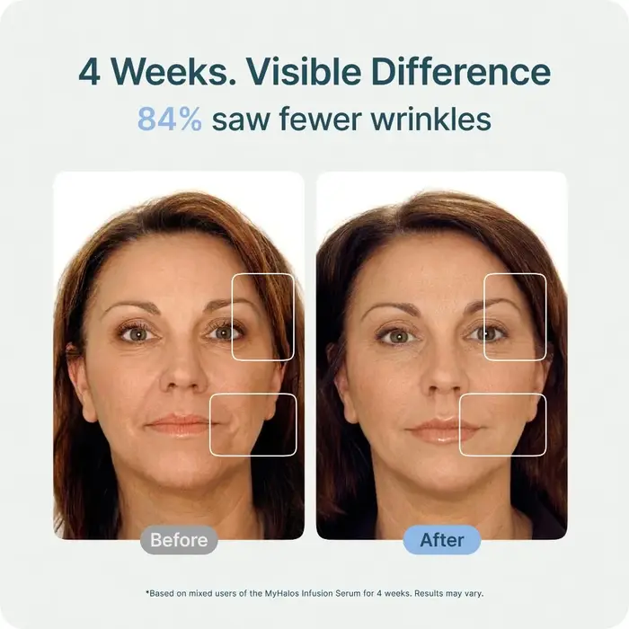 Ensemble de nettoyage et de soin du visage avec rouleau pour la peau