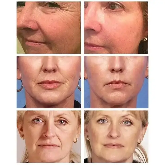 Crème pour le visage au rétinol déformable remodelé