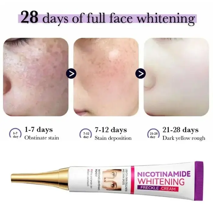 Crème éclaircissante au Melasma Niacinamide douce