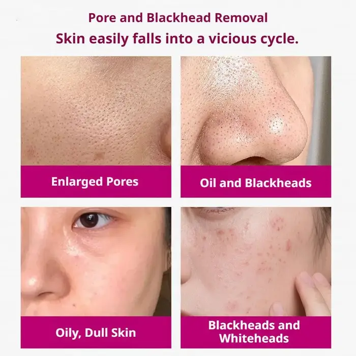 Sérum à l'acide salicylique pour resserrer les pores