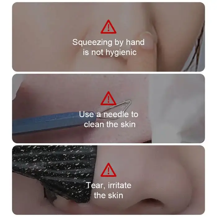 Masque facial pour l'élimination des points noirs