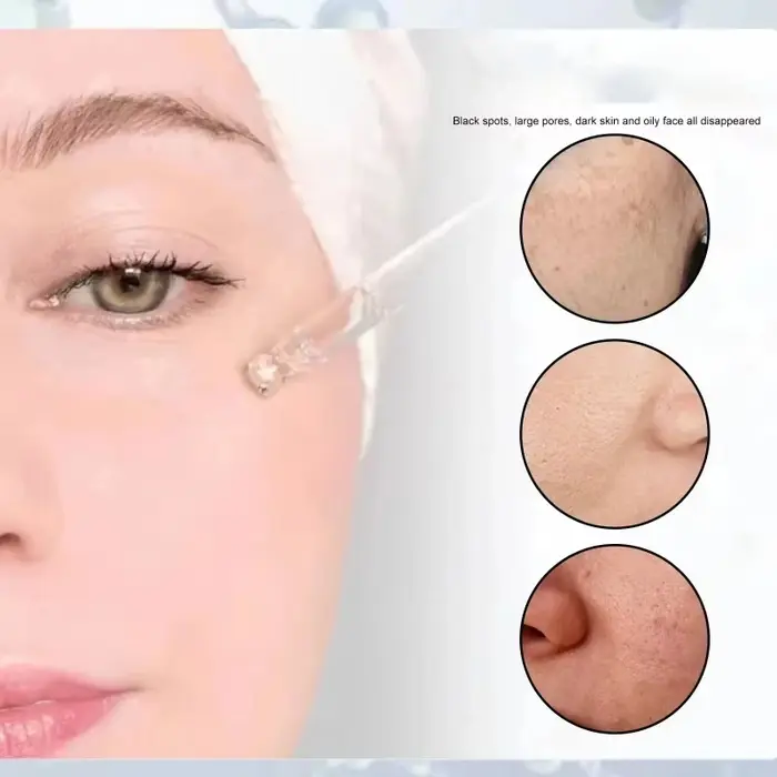 Sérum au collagène peptidique, essence anti-acné, améliore l'éclat de la peau, hydrate en profondeur, lisse la texture de la peau, produits coréens