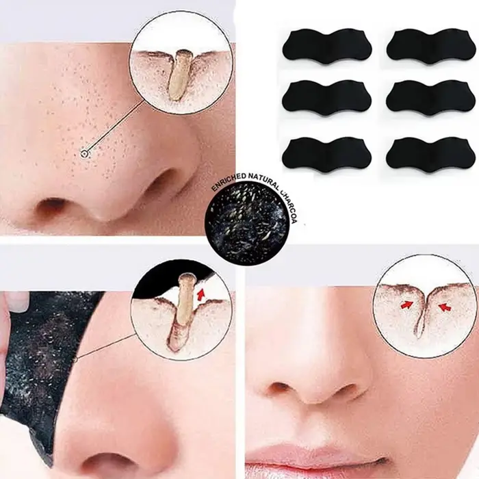 Nez points noirs dissolvant masque bandes nasales tête noire nez