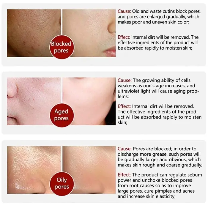 Skin Bergamo | Pore Refining Resurfacing