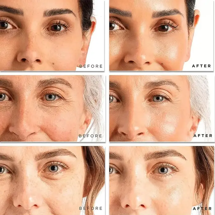 Crème anti-rides instantanée pour le visage