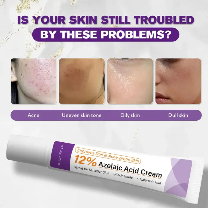 Crème à l'acide azélaïque douce améliore la peau terne, lisse la texture rugueuse, lotion quotidienne non irritante pour le soin du visage.