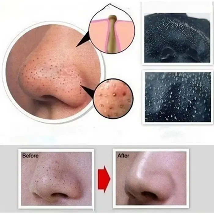Masque anti-points noirs au charbon de bambou