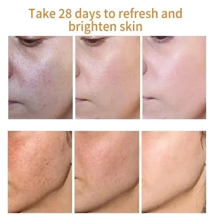 Crème blanchissante à la niacinamide pour le visage