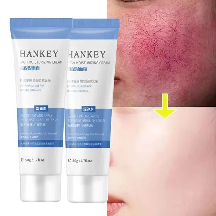 Crème réparatrice pour les rougeurs du visage