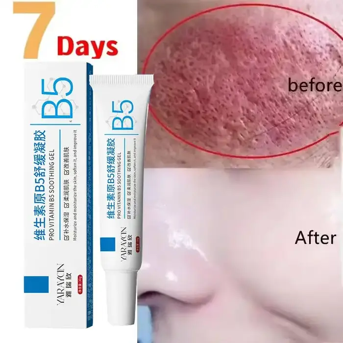 Crème réparatrice pour les rougeurs du visage