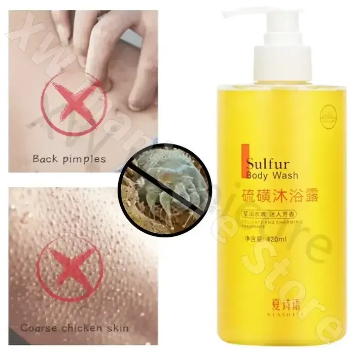 Gel Douche Anti-Acariens pour Homme et Femme