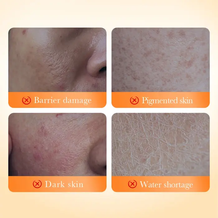 30 pièces/boîte BIOAQUA vitamine C blanchissant visage sérum ensembles