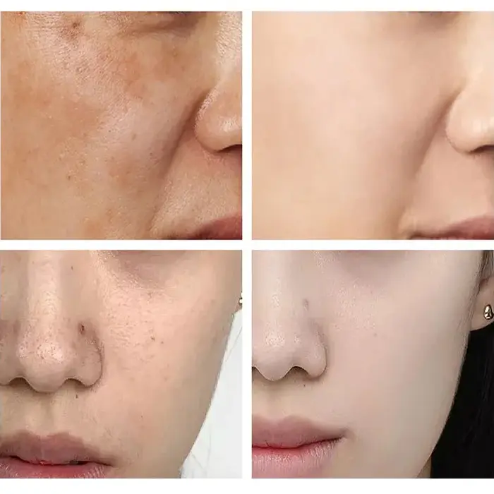 + crème solaire coréenne blanchissante pour le visage