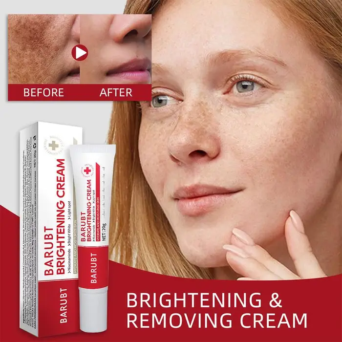Crème Éclaircissante Anti-Taches pour le Visage – Correcteur de Mélasma et Taches Brunes – Atténue la Pigmentation de la Mélanine – Soin de Beauté Illuminateur