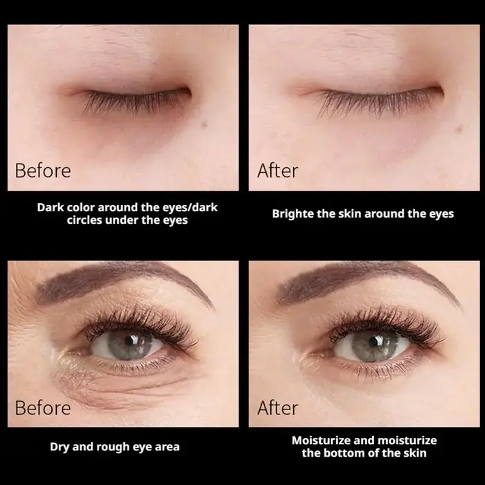 Masque Contour des Yeux Coréen Mercilen Peptide Golden Collagen Anti-Rides Double Action Raffermissant Lissant Anti-Cernes Soin de la Peau