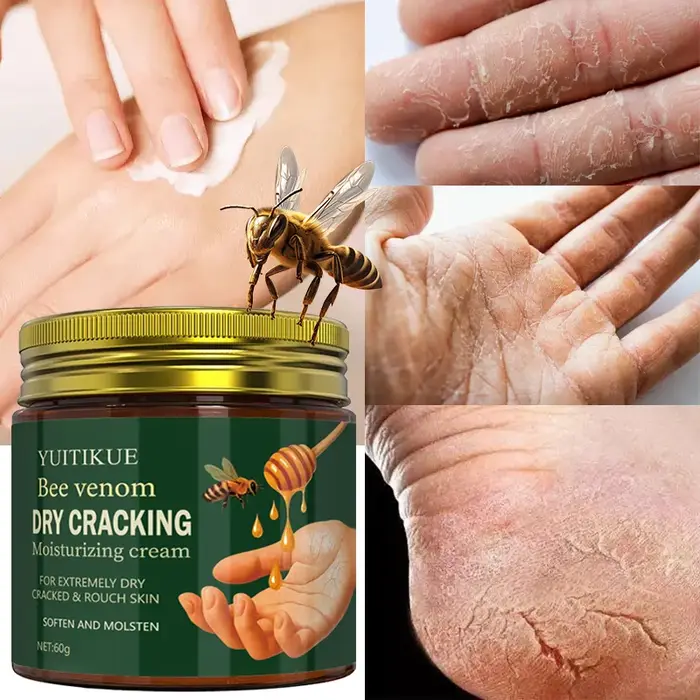 Crème réparatrice au venin d'abeille 60g – Réparation intensive pour mains/pieds différents secs et 