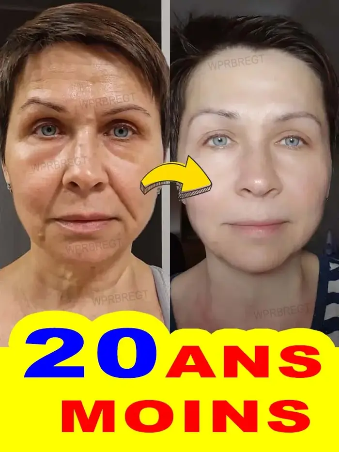 20 ans plus jeunes, pas de ridules
