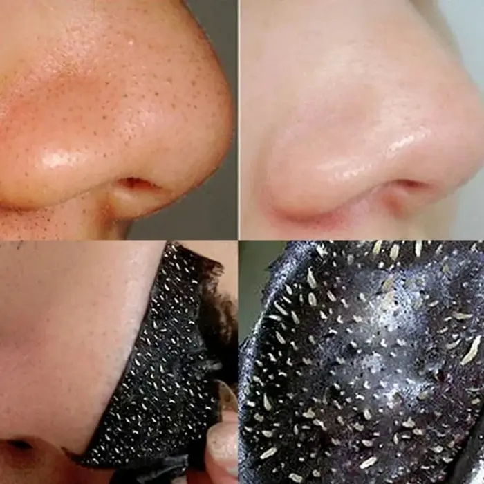 Masque dissolvant de points noirs pour le visage