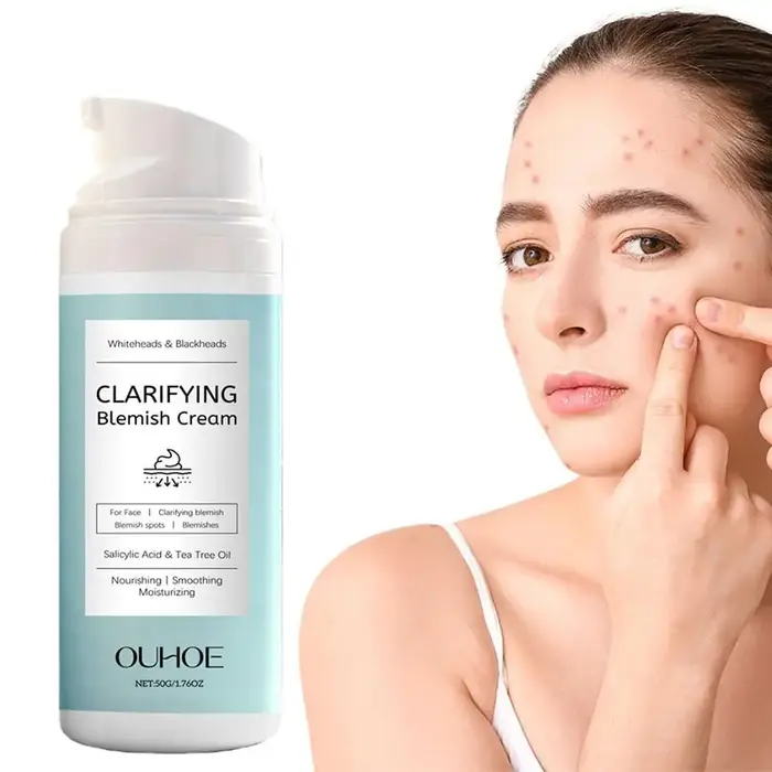 Crème pour le visage à l'acide salicylique